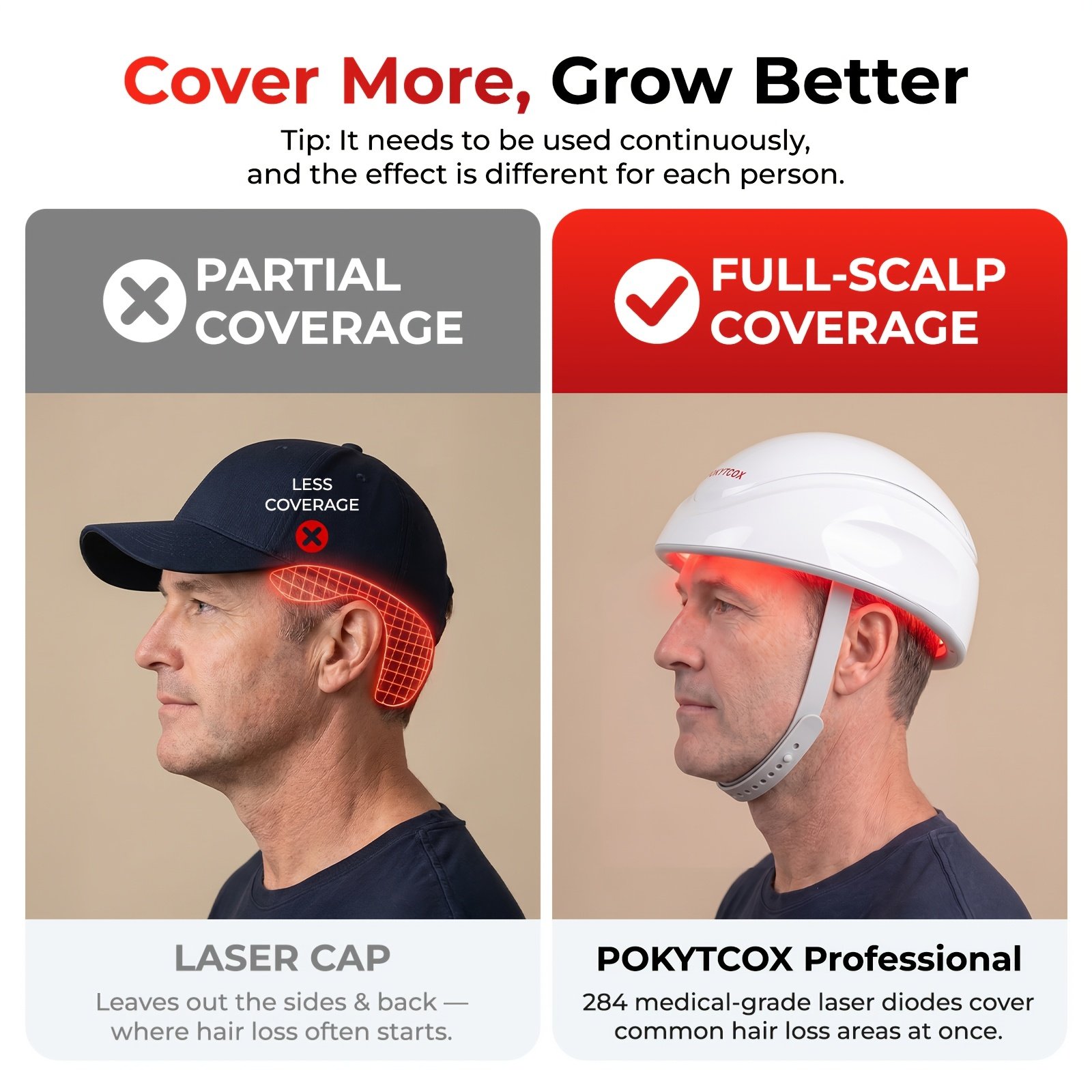 Laser Red Light for Hair Growth Laser Red Light for Hair Growth - Image 6