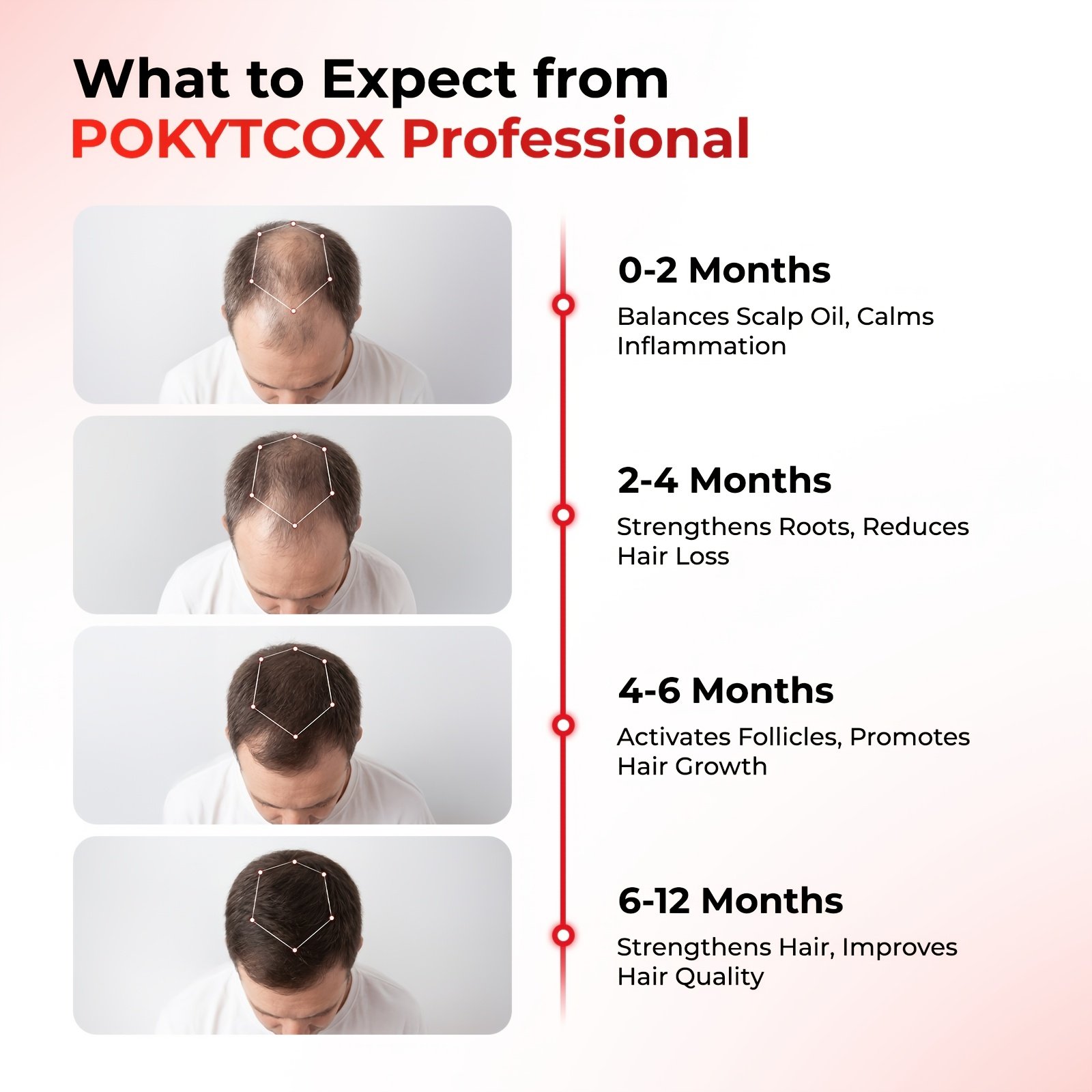Laser Red Light for Hair Growth Laser Red Light for Hair Growth - Image 9