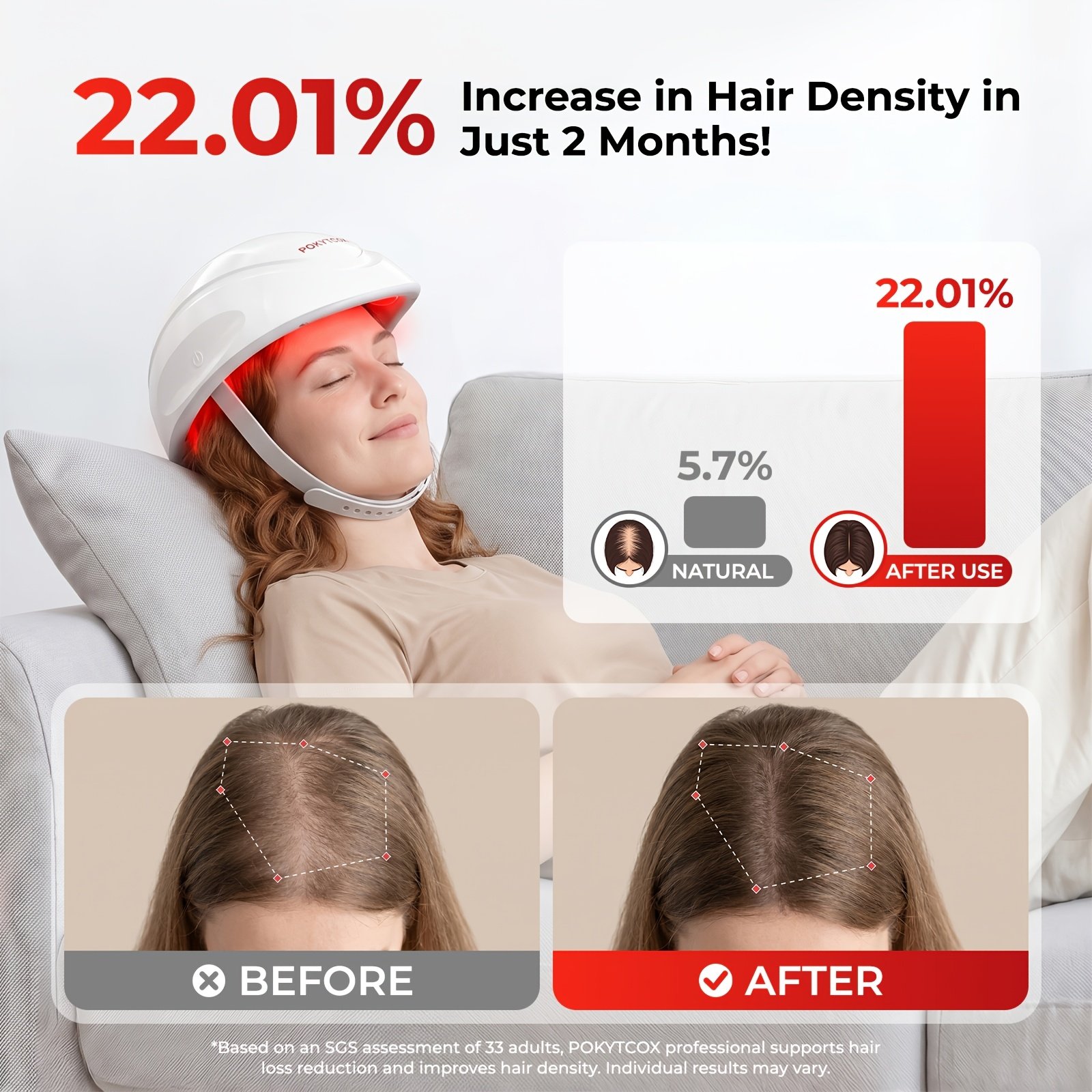Laser Red Light for Hair Growth Laser Red Light for Hair Growth - Image 2